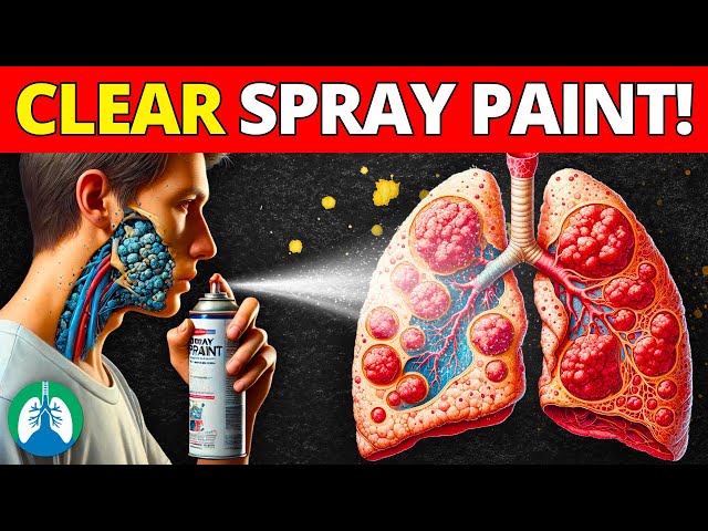 Can Paint Fumes Kill You